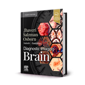 Diagnostic Imaging Brain — 4th Edition